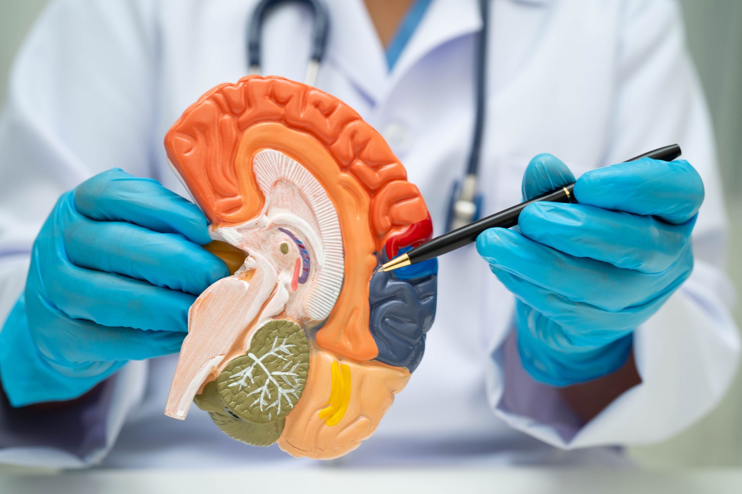 лечение альцгеймера