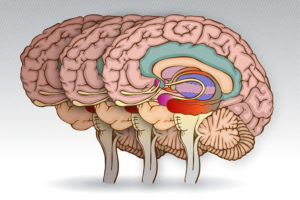 мозг при деменции