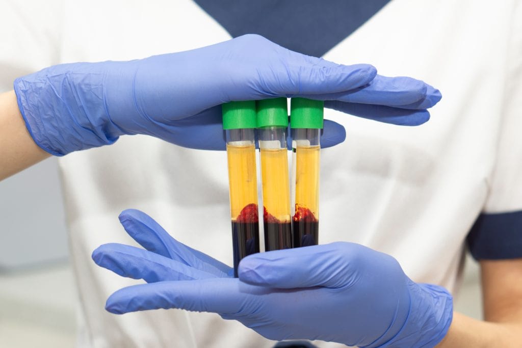 лабораторные исследования крови